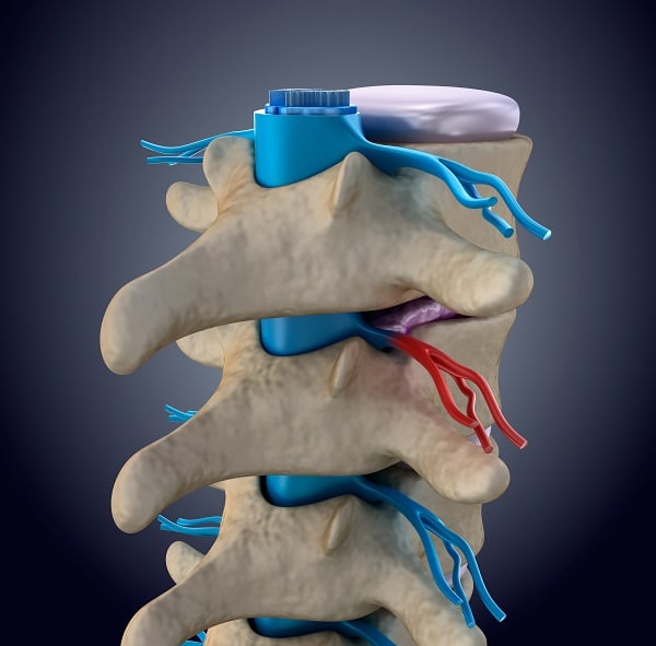 What Are the Different Types of Spinal Cord Injuries?