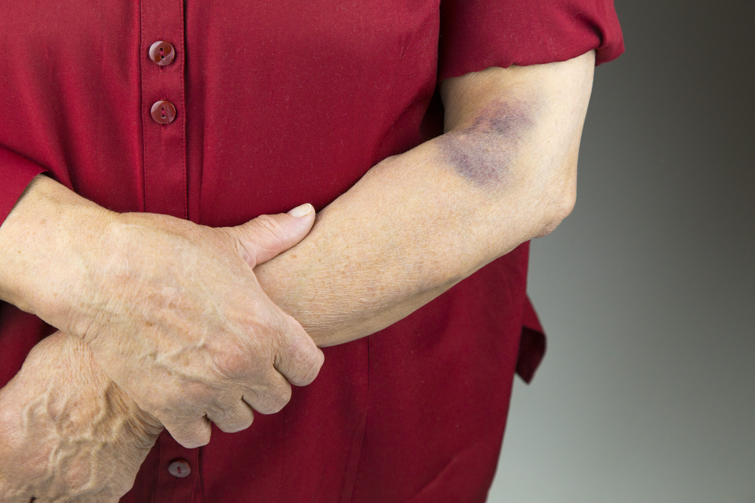 What are the Signs of Nursing Home Abuse?