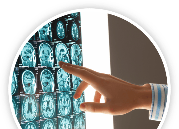 Madison Traumatic Brain Injury Lawyers