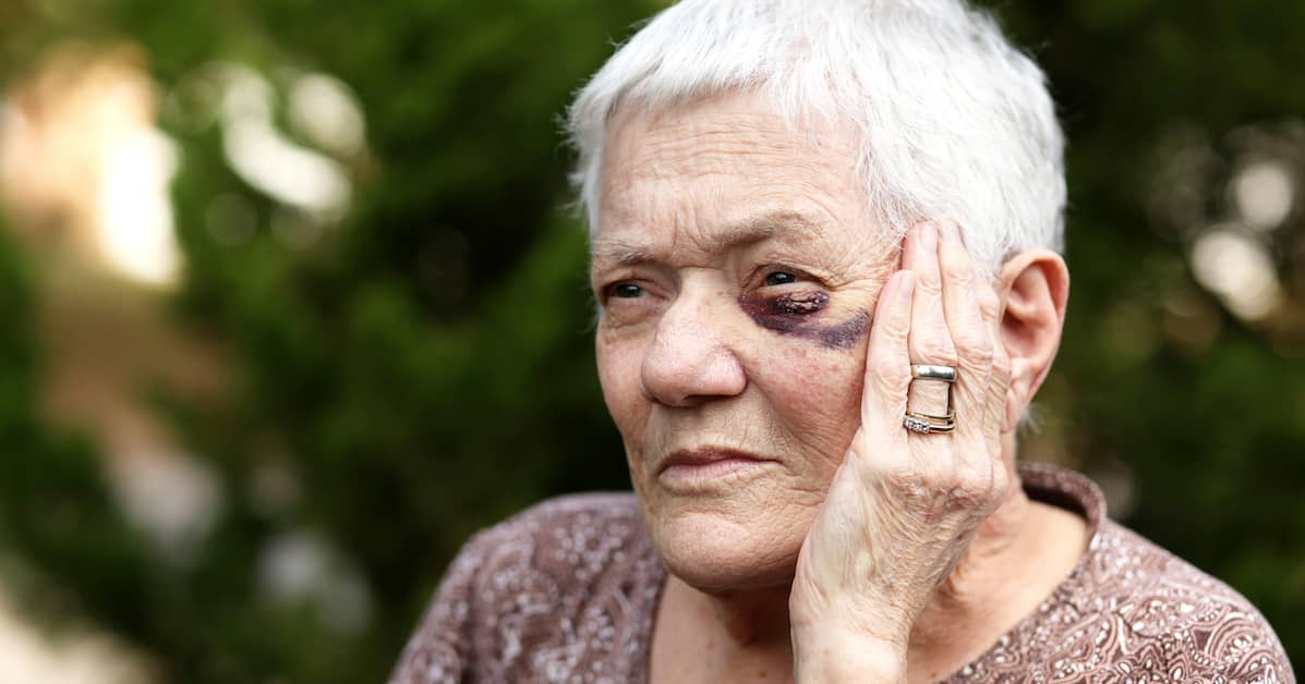 elderly woman with black eye - Boller and Vaughan